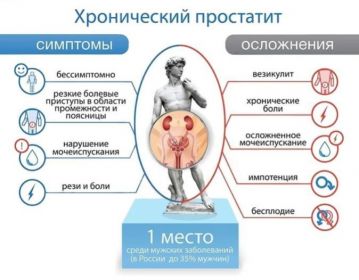 Простатит. Причины, диагностика, лечение